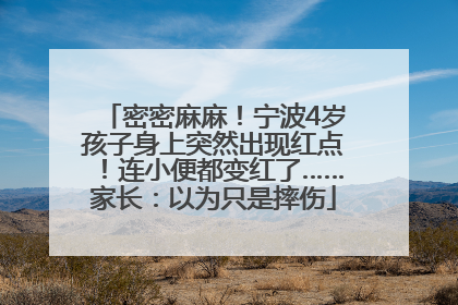 密密麻麻！宁波4岁孩子身上突然出现红点！连小便都变红了……家长：以为只是摔伤
