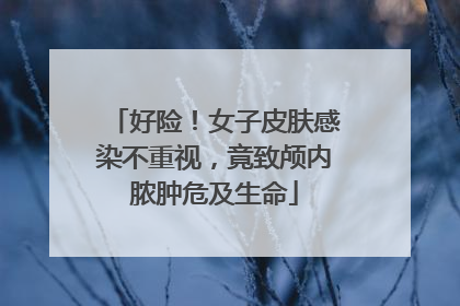 好险！女子皮肤感染不重视，竟致颅内脓肿危及生命